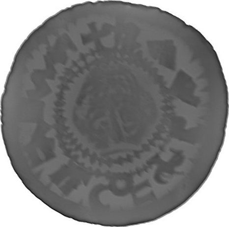 RTG snímek