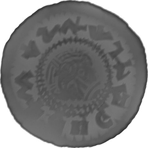 RTG snímek