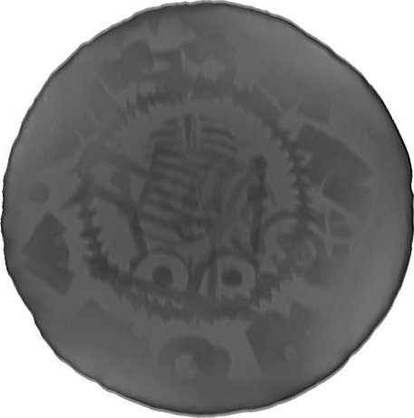 RTG snímek