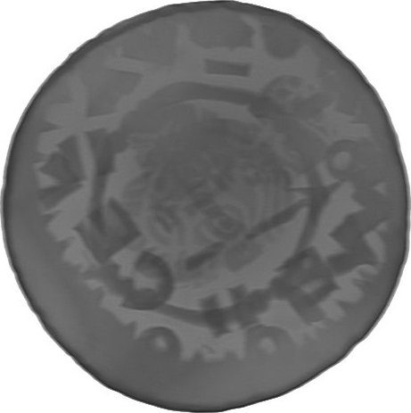 RTG snímek