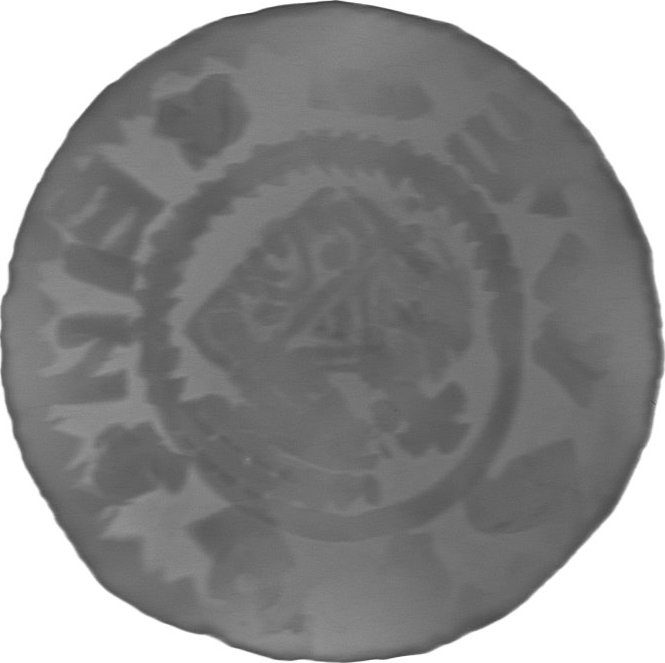 RTG snímek