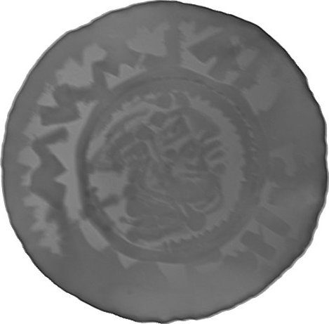 RTG snímek