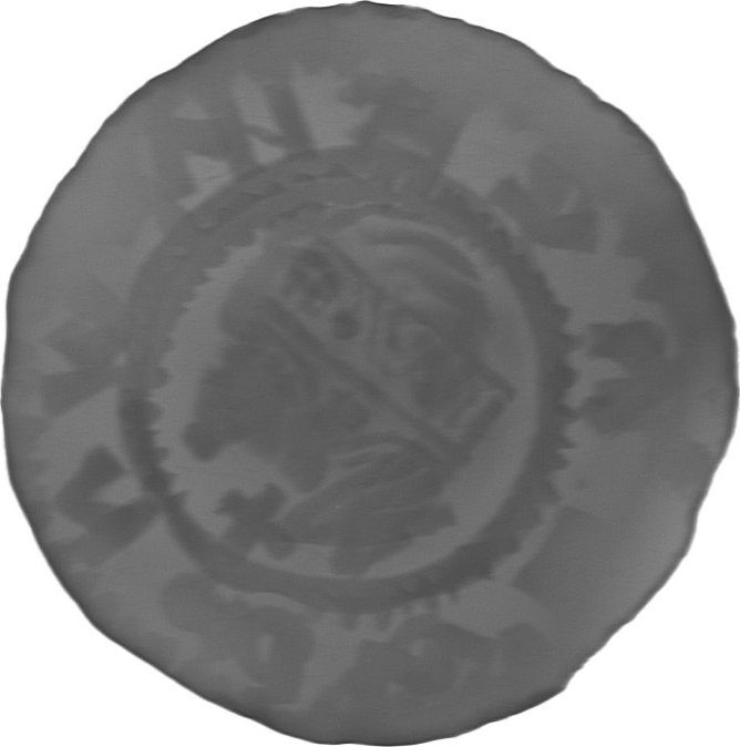 RTG snímek