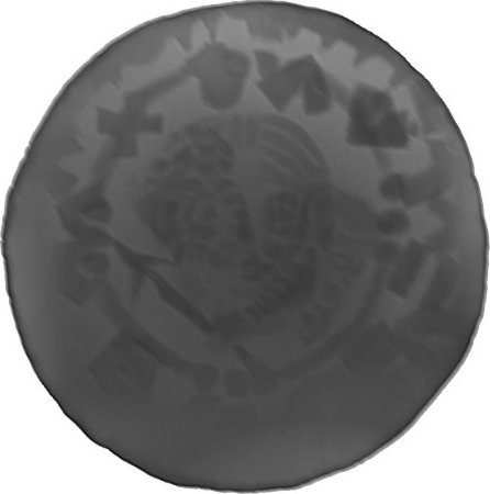 RTG snímek