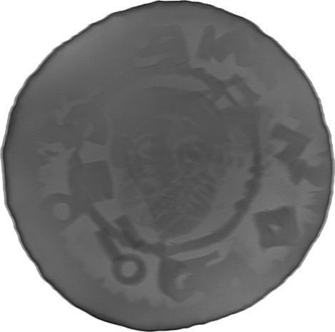 RTG snímek