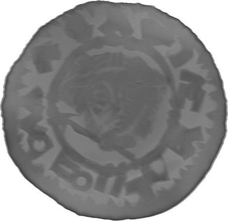 RTG snímek
