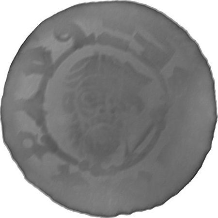 RTG snímek