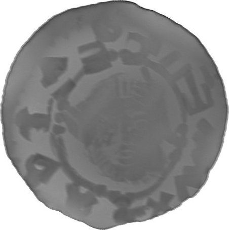 RTG snímek