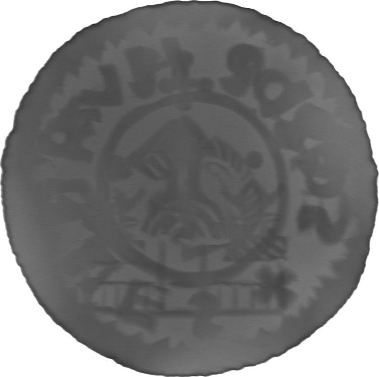 RTG snímek