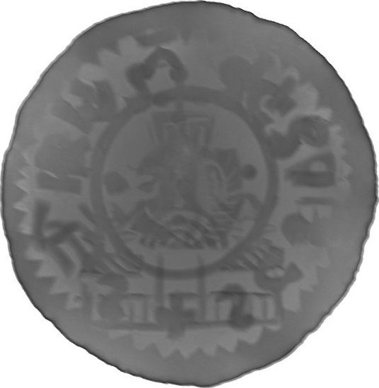 RTG snímek