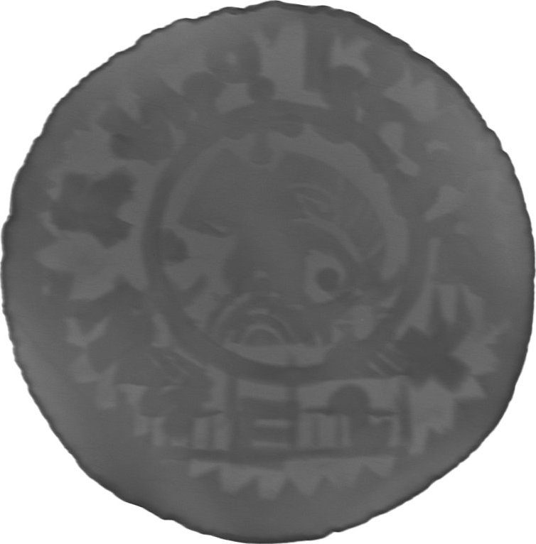 RTG snímek