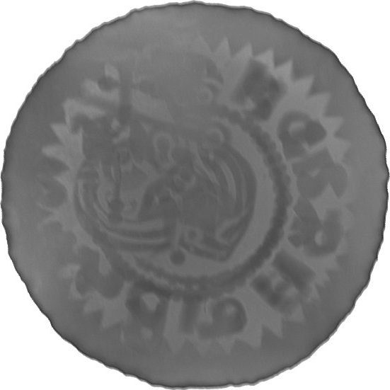 RTG snímek