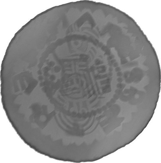 RTG snímek