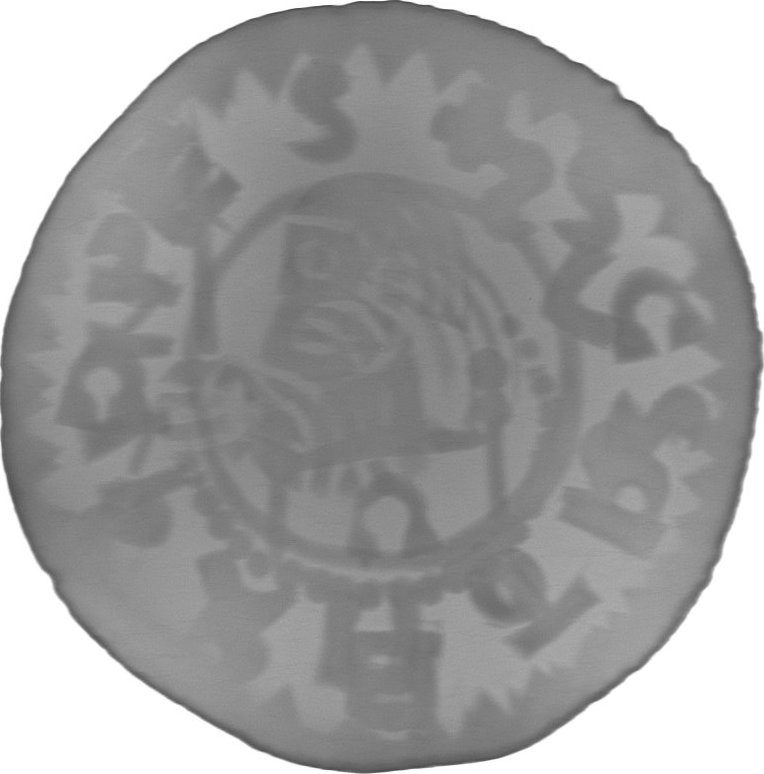 RTG snímek