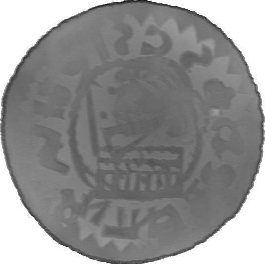 RTG snímek