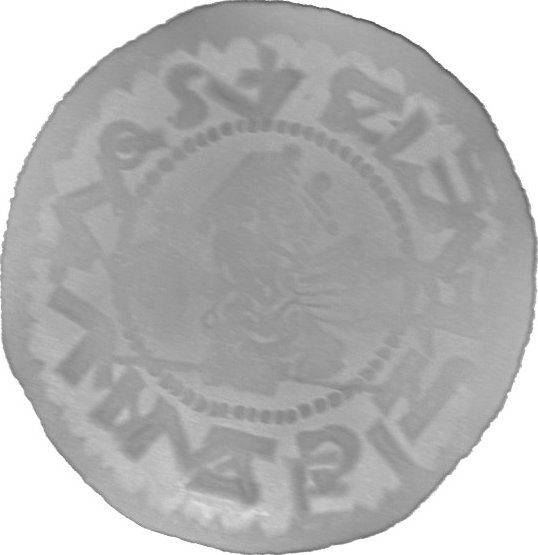 RTG snímek