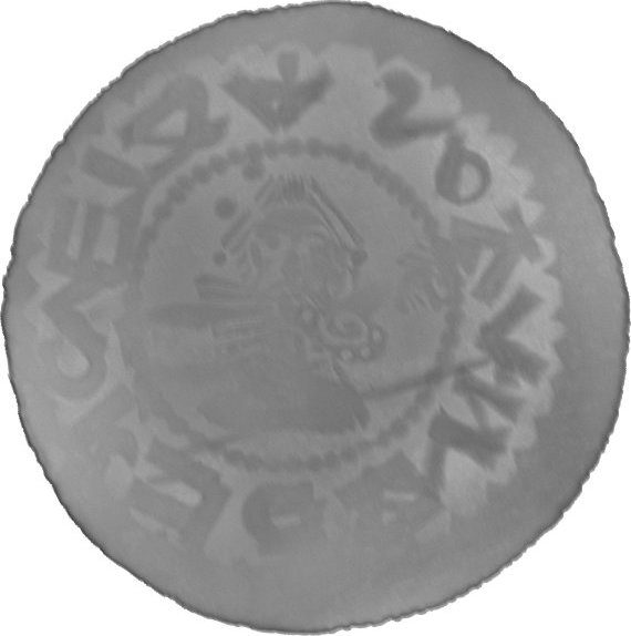 RTG snímek