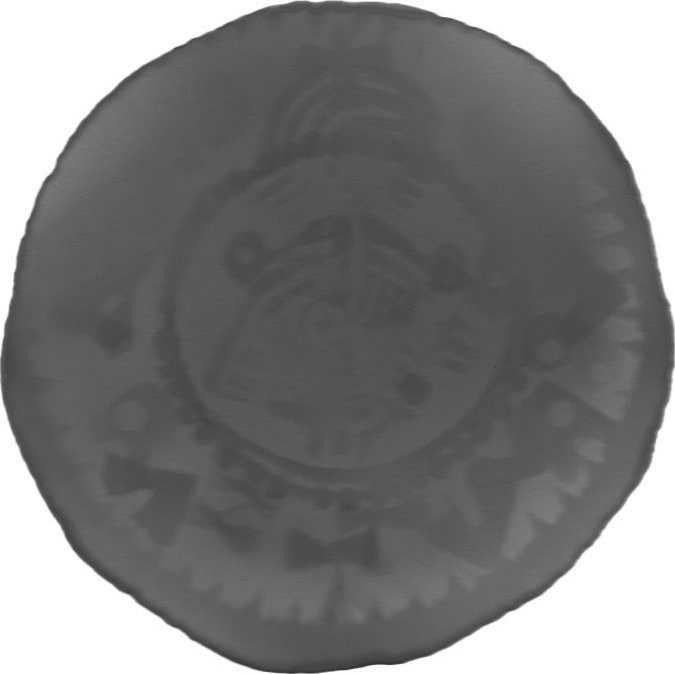 RTG snímek