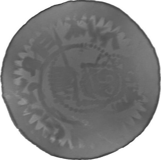 RTG snímek