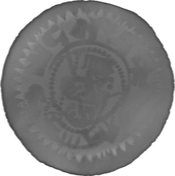 RTG snímek