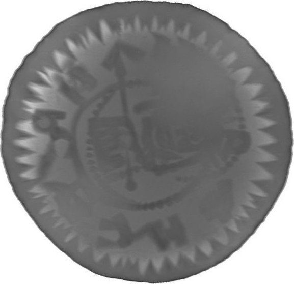 RTG snímek