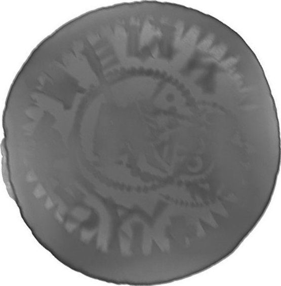 RTG snímek