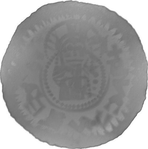 RTG snímek