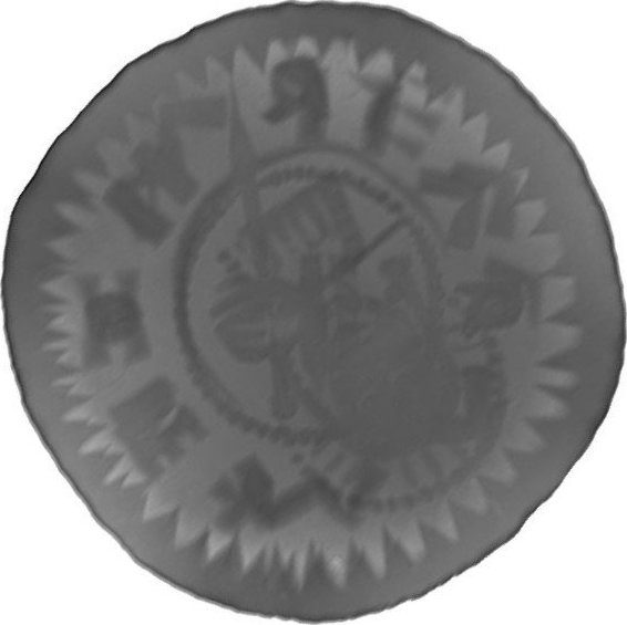 RTG snímek
