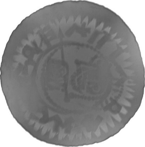RTG snímek