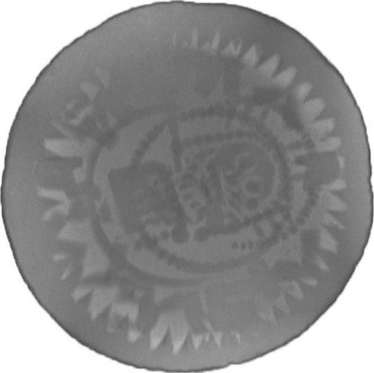 RTG snímek