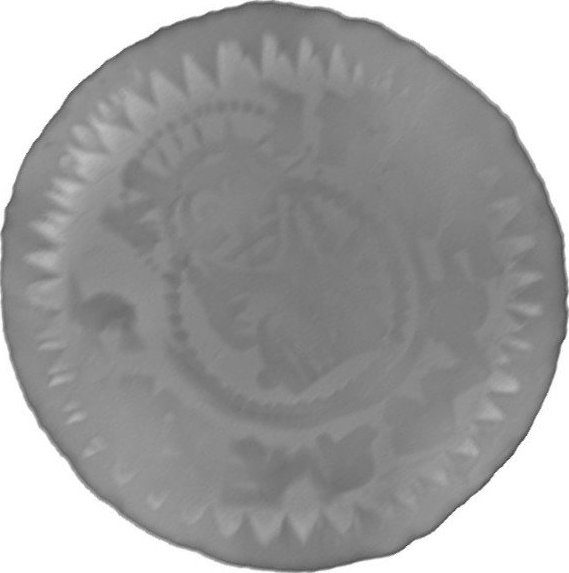 RTG snímek