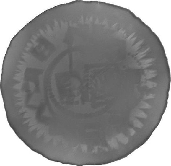 RTG snímek
