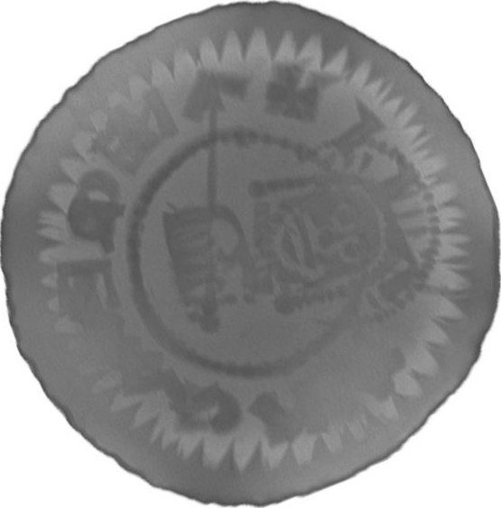 RTG snímek