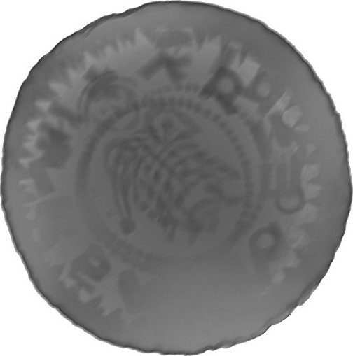 RTG snímek