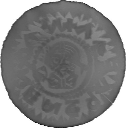 RTG snímek