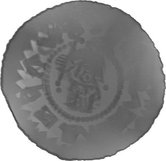 RTG snímek