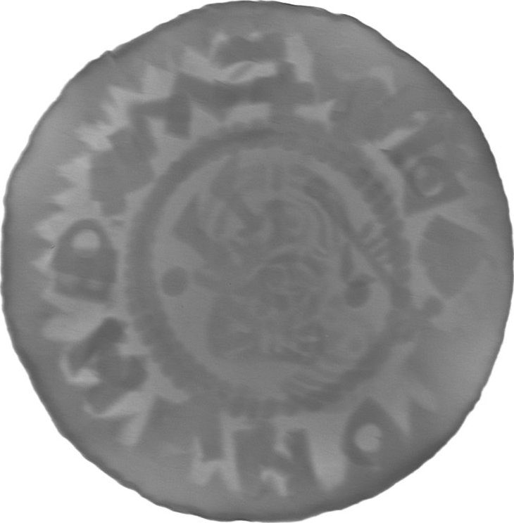 RTG snímek