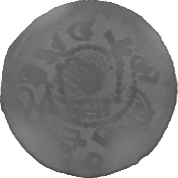 RTG snímek