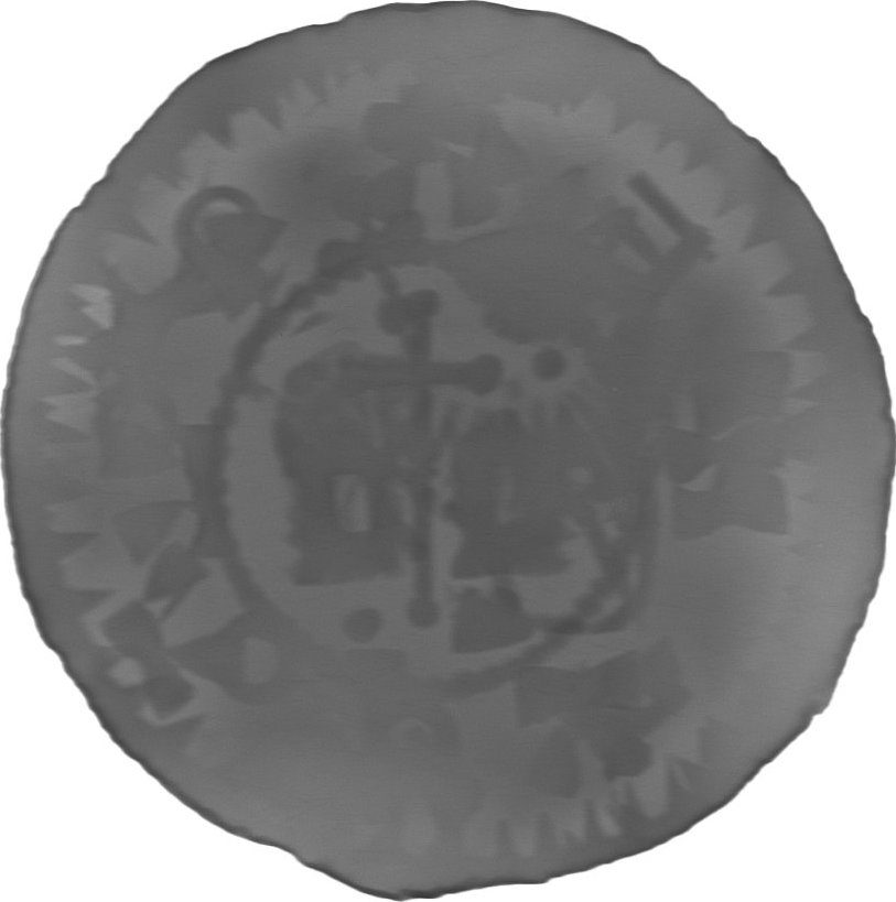RTG snímek