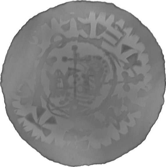RTG snímek