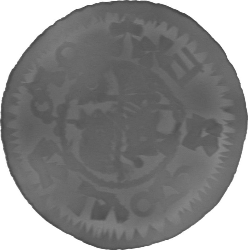 RTG snímek