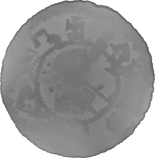 RTG snímek