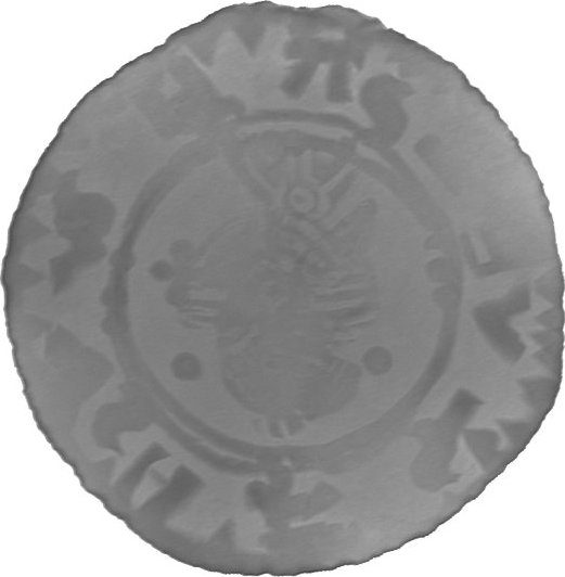 RTG snímek