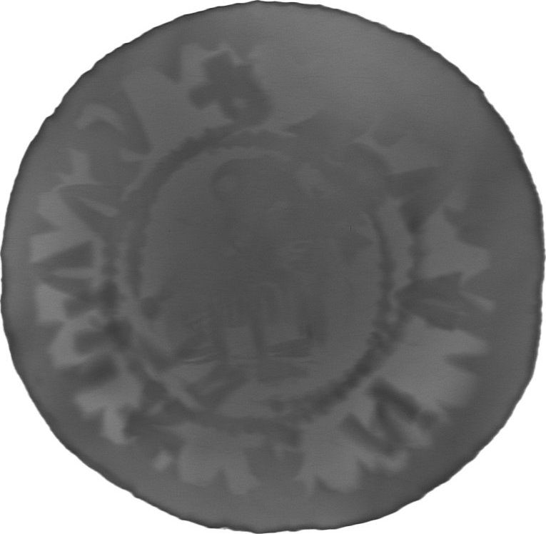 RTG snímek