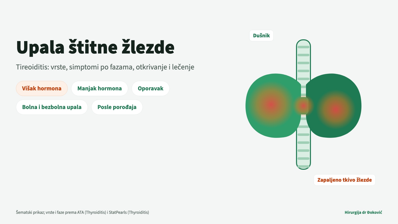 Upala štitne žlezde (tireoiditis): šematski prikaz zapaljene štitne žlezde ispred dušnika, uz tri faze upale – višak hormona, manjak hormona i oporavak – i podelu na bolne i bezbolne upale i upalu posle porođaja