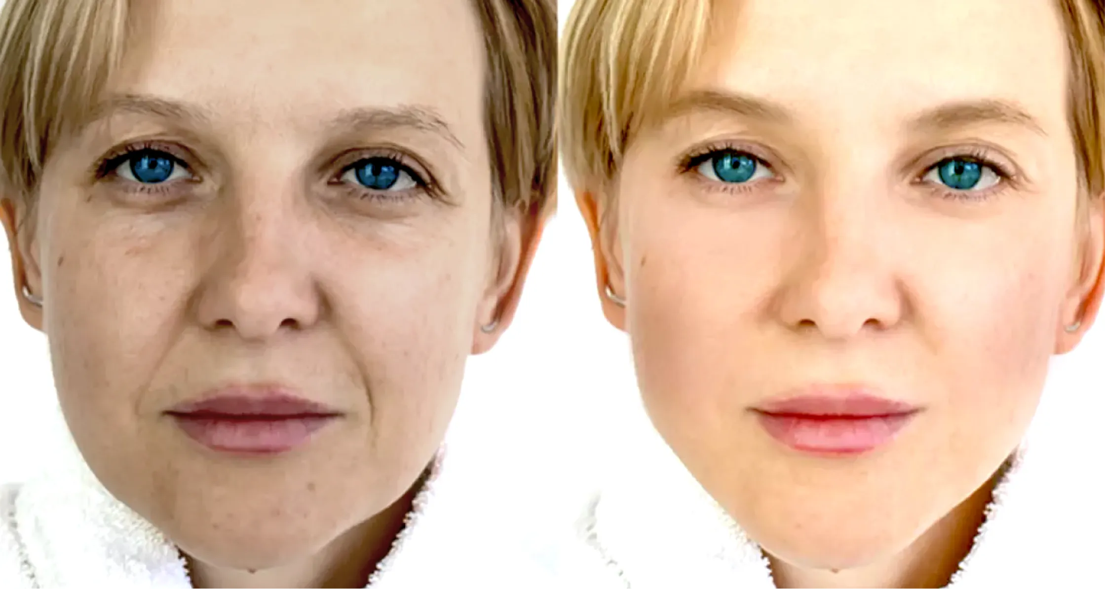 before-after-show-image