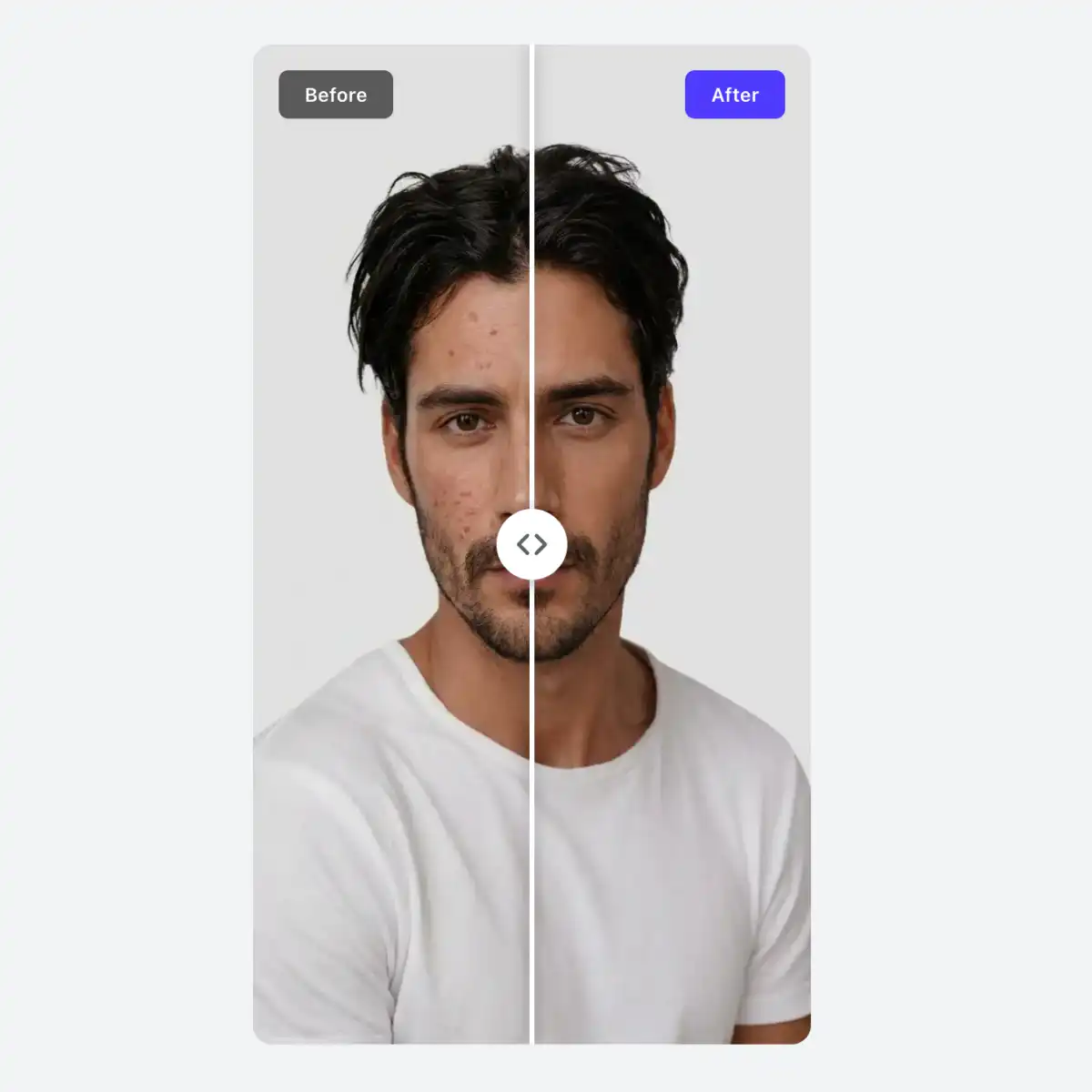 Overchat AI skin enhancer app