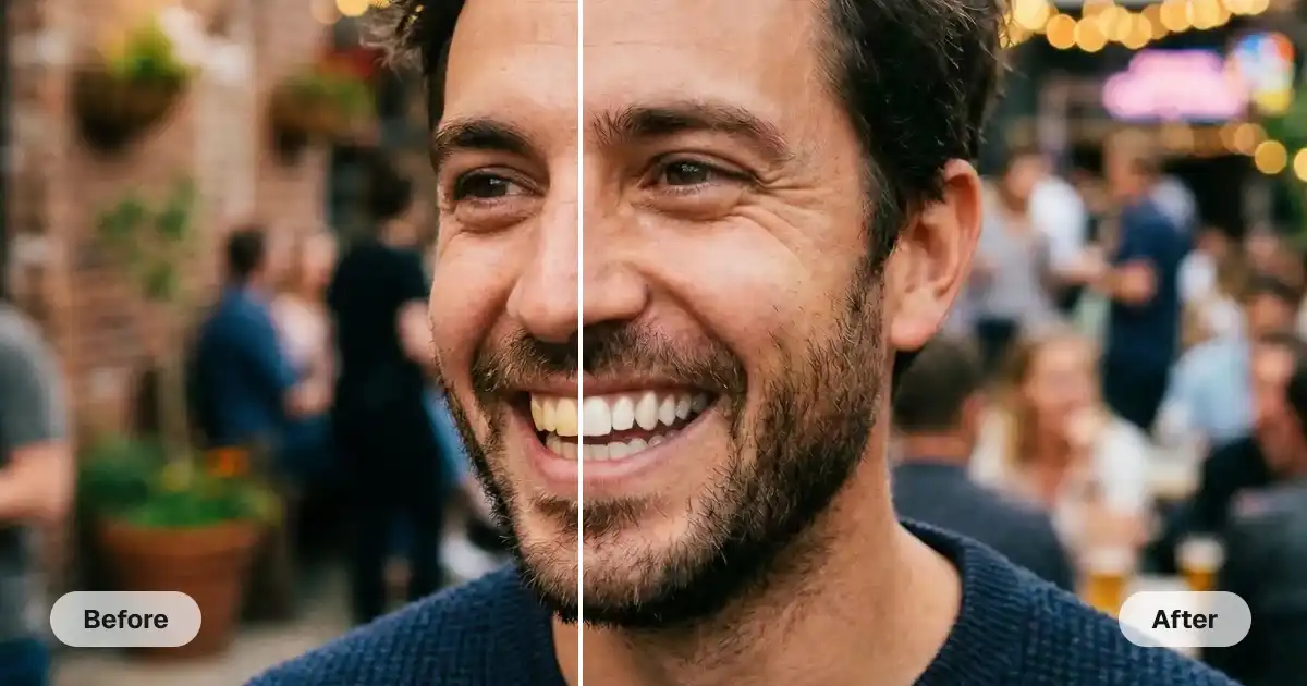 AI Teeth Whitening