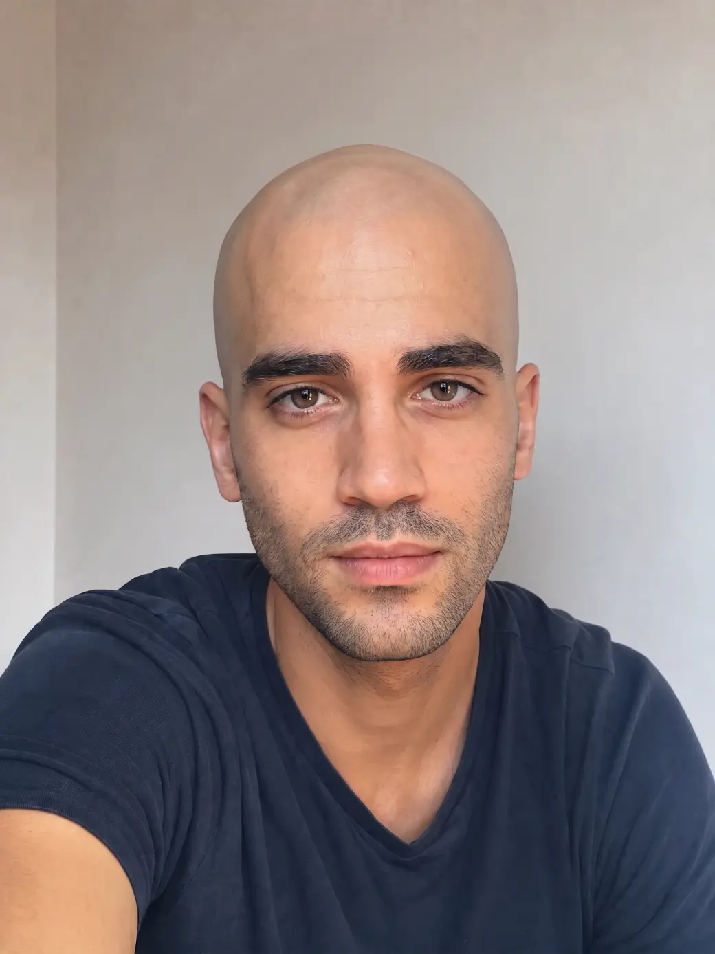 Same person with an AI-generated bald head