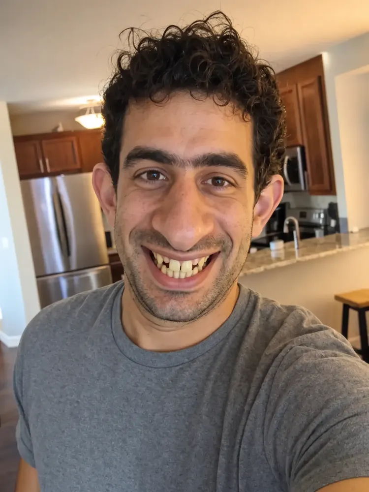 The same selfie with the funny ugly filter applied